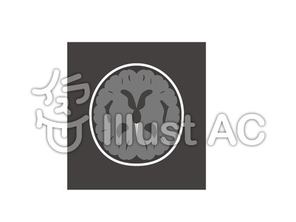 脳 Ctスキャンイラスト No 3927 無料イラストなら イラストac