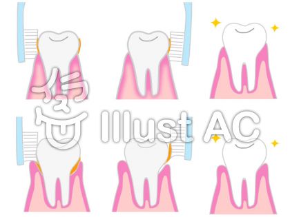 歯磨きのイラストイラスト 無料イラストなら イラストac