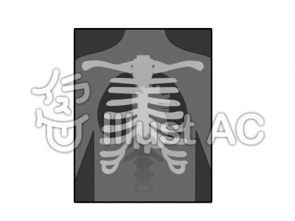 レントゲンイラスト 無料イラストなら イラストac